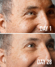 Before and after comparison of a man's face with text indicating 'Day 1' and 'Day 28'.