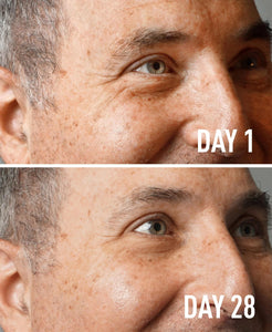 Before and after comparison of a man's face with text indicating 'Day 1' and 'Day 28'.